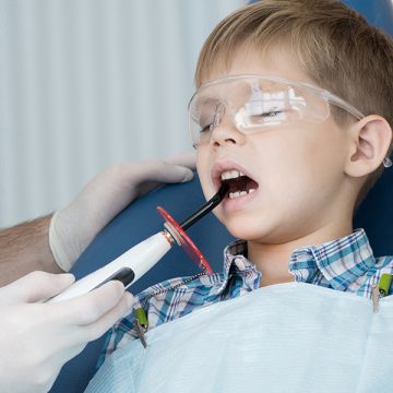 What Are the Situations When Kids Need Dental Extractions?